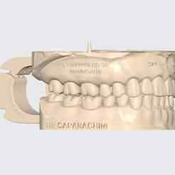 DR CAPARACHINI EDUCATIONAL MODEL